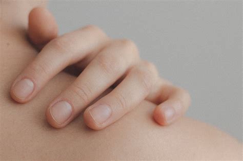 ALAMIN: Paunang lunas kapag napaso, nasunog ang .